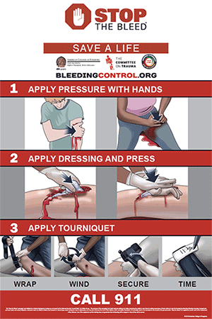 The American College of Surgeons, in partnership with President Obama’s administration and Federal agencies, created Stop the Bleed ® to train citizens in techniques to control bleeding. As of August 2017 more than 6,000 instructors in all 50 states have received training.