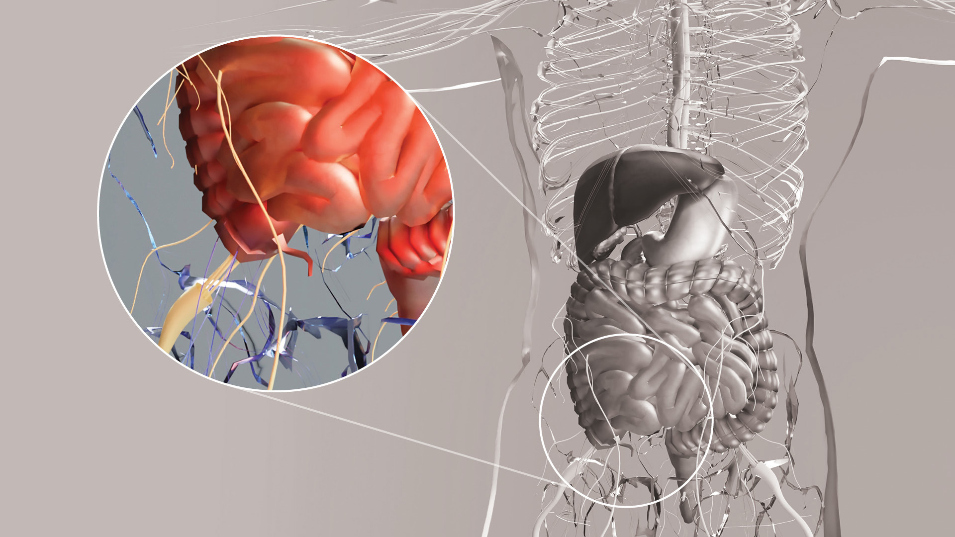 Are Antibiotics the Answer to Treating Appendicitis?