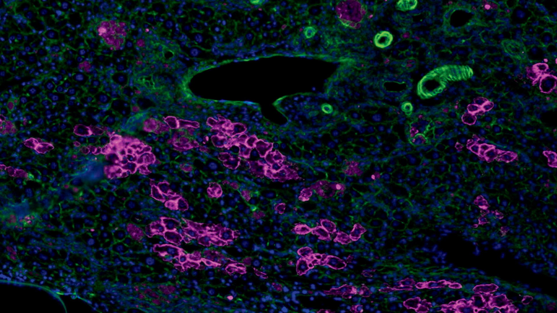 Innovations in Space-Grown Human Tissue Boosted by ACS Award