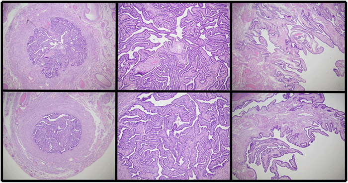 Top row (left to right): Left fallopian tube, left fallopian tube (higher magnification), left fimbria. No histological evidence of ischemic damage identified. Bottom row (left to right): Right fallopian tube, right fallopian tube (higher magnification), right fimbria