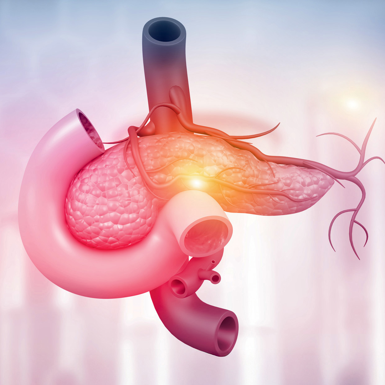 Pancreatic Surgery