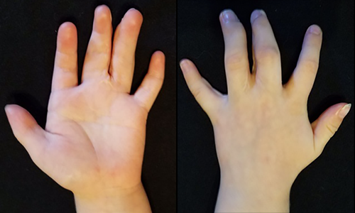 Figure 8. 21-months follow-up.